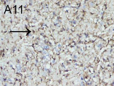 HUCB-MSCs