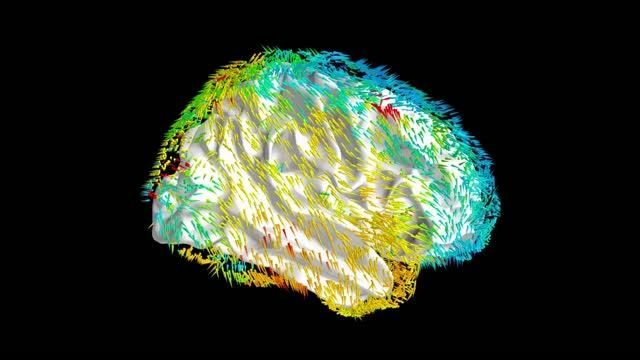 Animation Showing the Average Direction of Traveling Wave Propagation Across the Human Brain