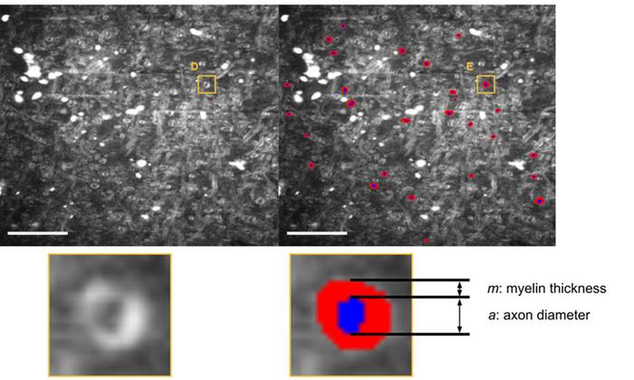 Example segmentation using a custom-trained AxonDeepSeg model