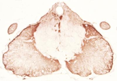 Injured Mouse Spinal Cord