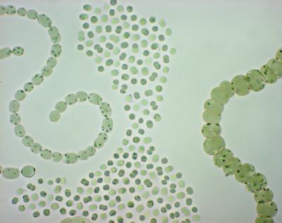 Global Qarming Favors Proliferation of Toxic Cyanobacteria