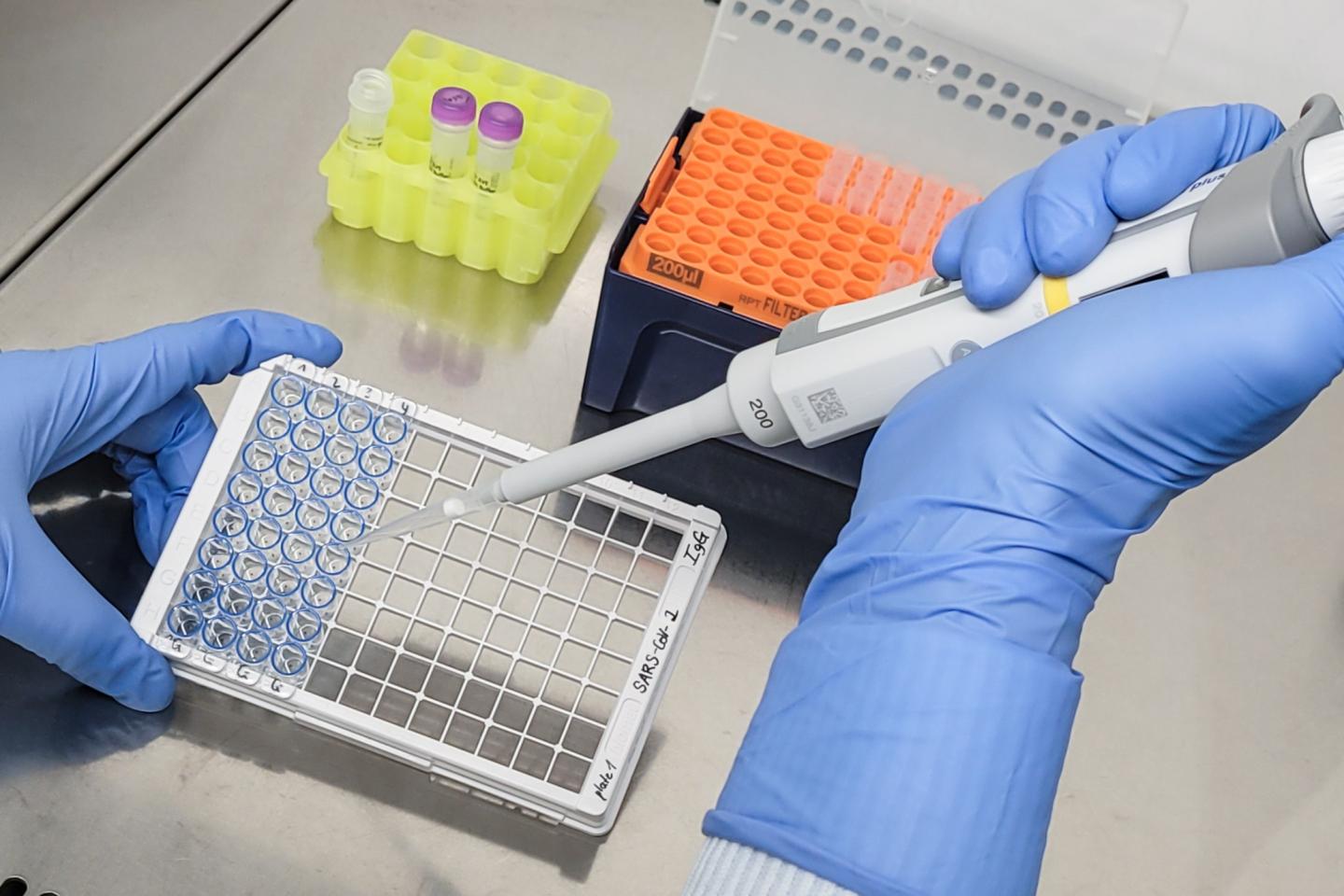 Testing for SARS-CoV-2-specific Antibodies