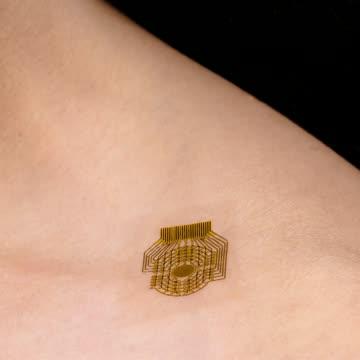 Data Visualization of Skin Patch and Shunt