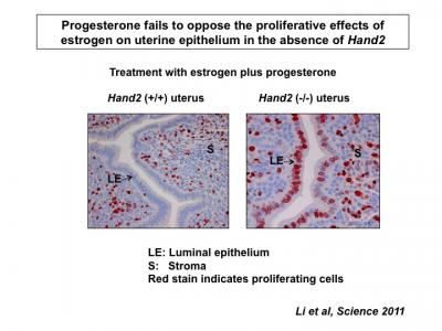 What's Behind Progesterone's Benefits in the Uterus? (1 of 2)
