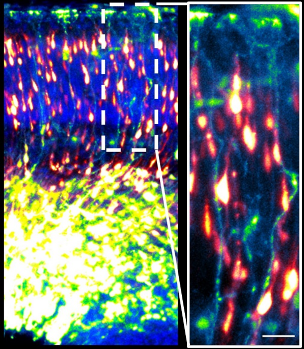 Migración neuronal