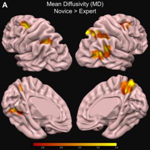 Being a birding expert may alter brain structure.