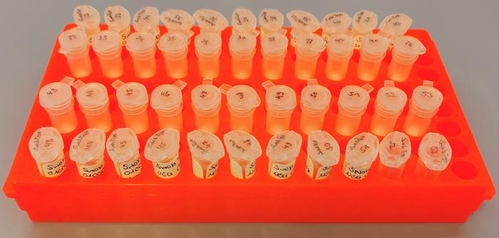 Microbiome_dna samples