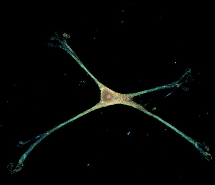 An astrocyte on nanowires