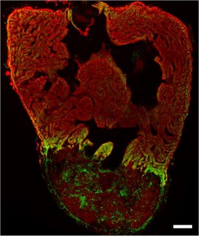 Activity of a Glycolytic Transporter in the Border Zone of the Zebrafish Heart