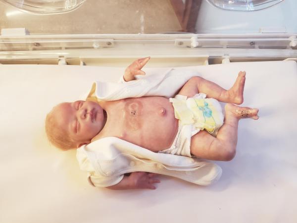 Baby Monitoring -- Patch