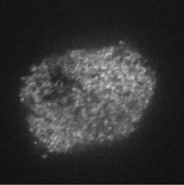U-M Researchers Find Noninvasive Way to View Insulin in Pancreas