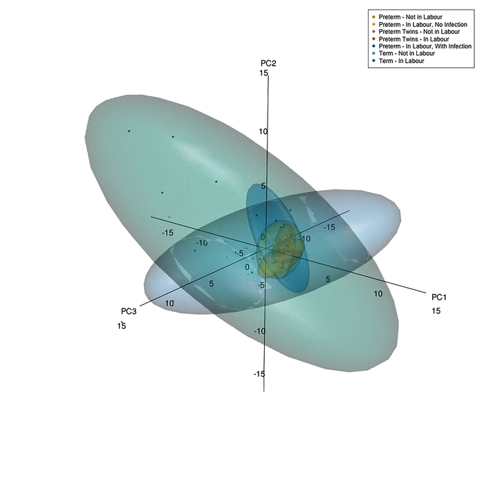 Principal component analysis