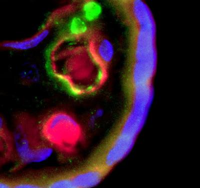 Placental Stem Cells