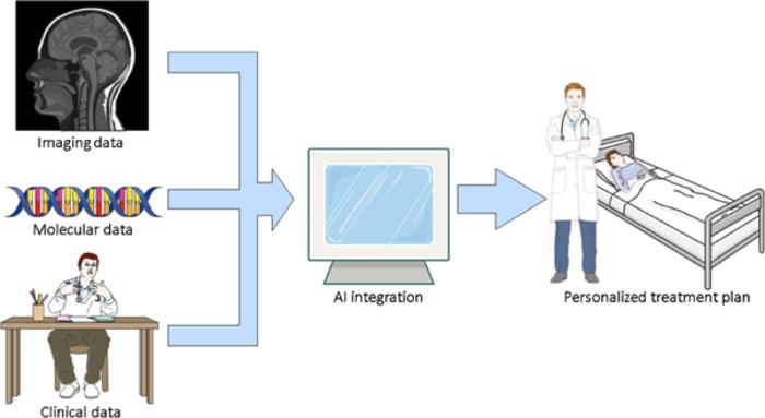 Transformative potential of Artificial intelligence (AI) in glioblastoma (GBM)