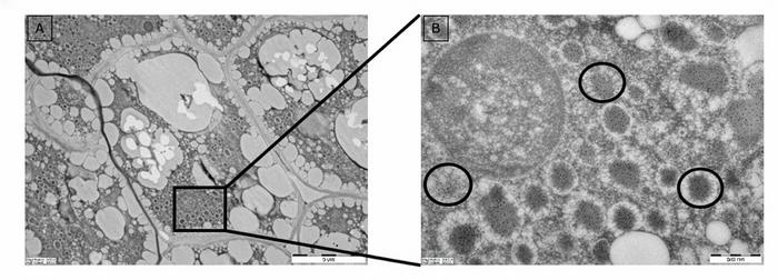 Microscope Reveals Surprising Milk Protein Clusters in Engineered Seeds