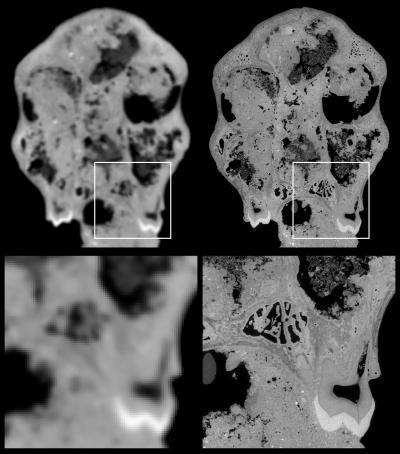 Comparison with CT Scanner