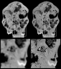 Comparison with CT Scanner