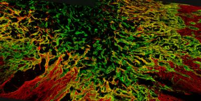 Axon Regeneration