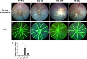 Representative fundus photographs (A–D) and FFA (E–H) of the retinas in the NC and EIU groups