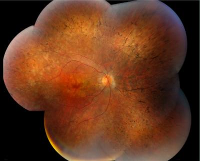 Human Retina