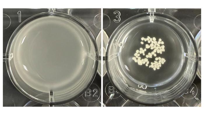 Flocculated yeast