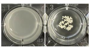 Flocculated yeast