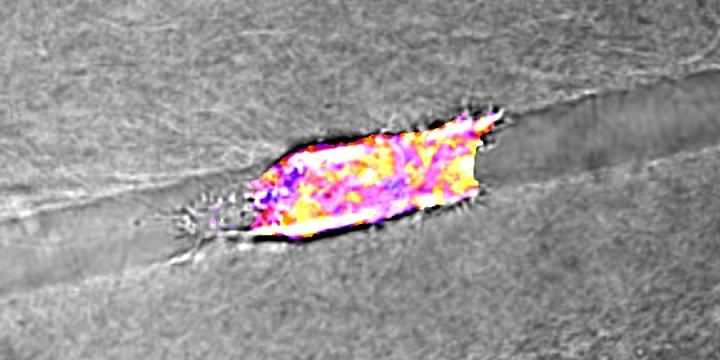 Figure: Cancer Cell Energy Levels during Migration