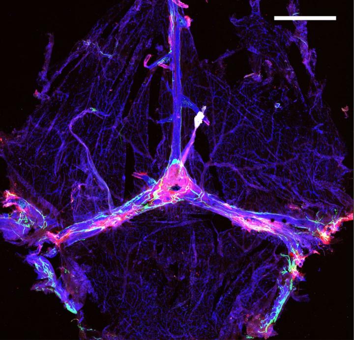 Meningeal lymphatics