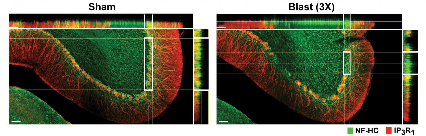 Further Insights into How Blast Exposure Causes Persistent Brain Injuries