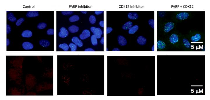 Ewing Cells Respond to CDK12 and PARP Inhibition