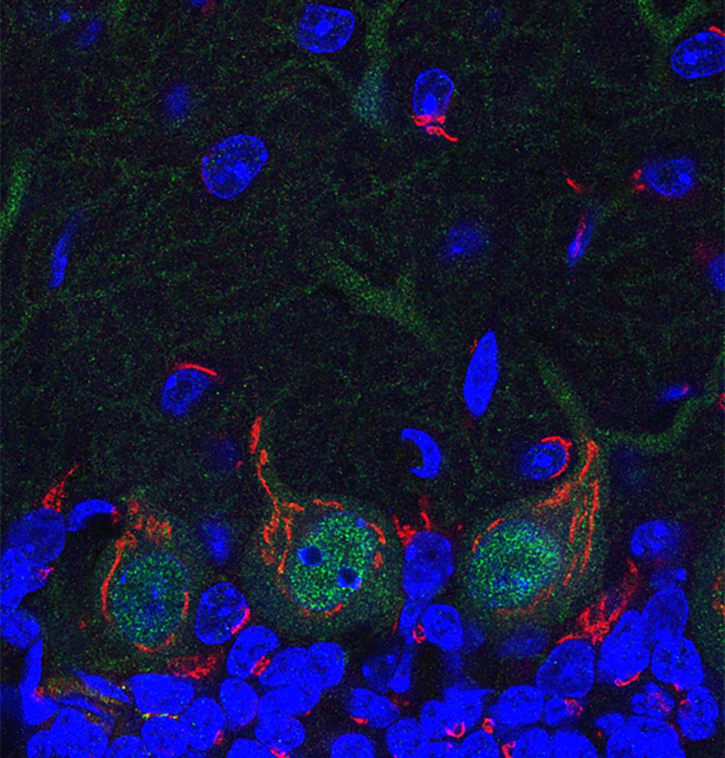 Neurodegeneration (2 of 2)