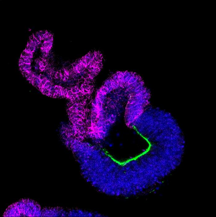 Neural tube organoid morphogenesis after ZIC2 knockdown