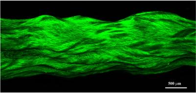 Growing Tendon