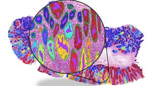 Representative Pathology Image