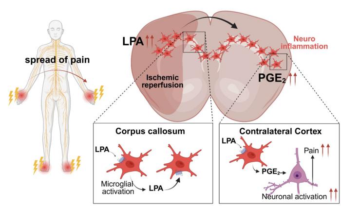 The development of mirror-image pain