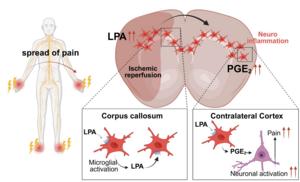 The development of mirror-image pain