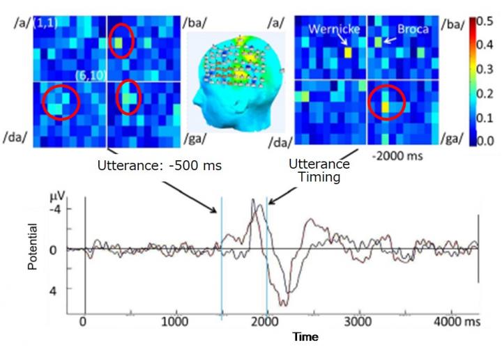 Activated Brain Region
