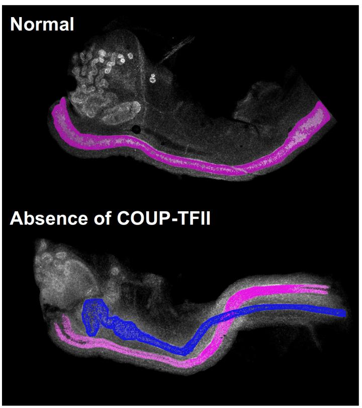 Image of Female Mouse Embryos With and Without COUP-TFII