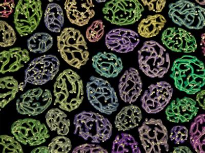 Mitochondrial Networks in Yeast Cells
