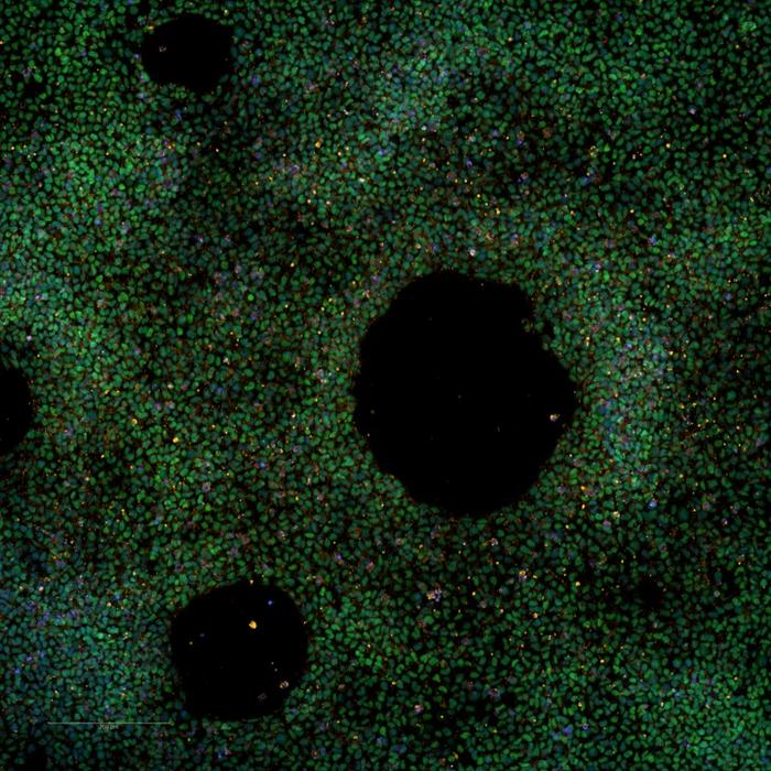 First large-scale stem cell bank enables worldwide studies on genetic risk for Alzheimer’s disease