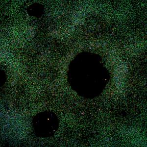 First large-scale stem cell bank enables worldwide studies on genetic risk for Alzheimer’s disease