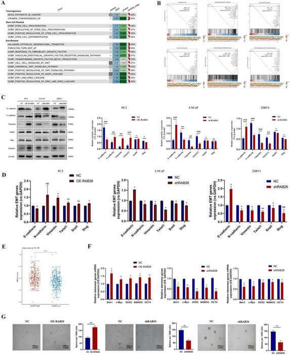 RAB26 promotes epithelial–mesenchymal transition and stem cell-like characteristics of prostate cancer cells.