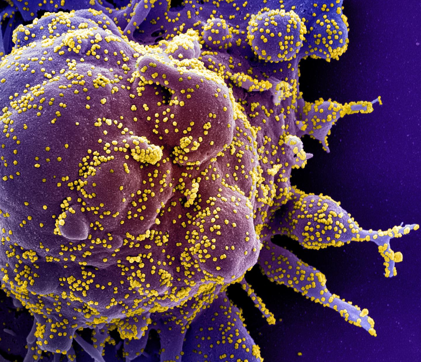 Colorized Scanning Electron Micrograph