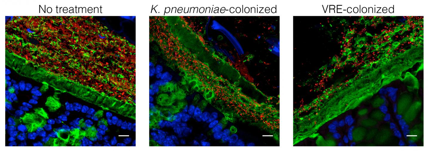 Commensal Bacteria and Colonic Tissue