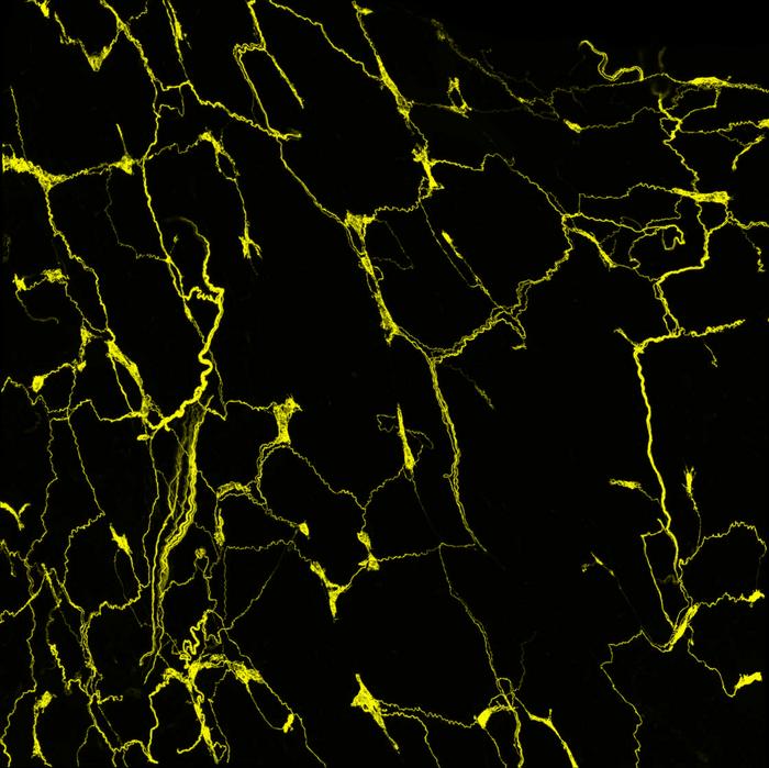 The axons of the sensory neurons form an intricate network in the mouse esophagus.