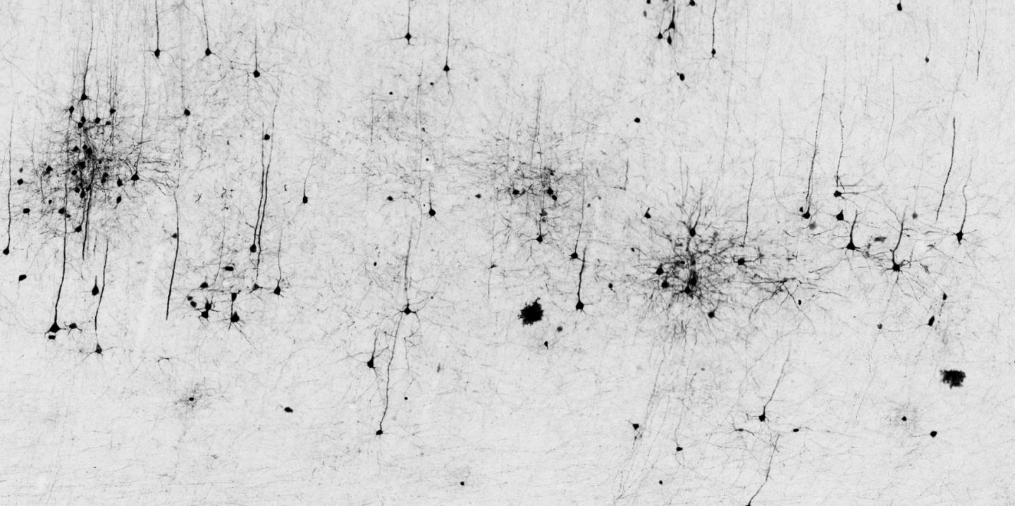 Physical Positioning Dramatically Enhances Brain Transduction After Intrathecal AAV9 Infusion (7-7)
