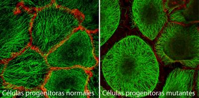 Mutant Epidermal Stem Cells Lose the Connections to Their Neighbors