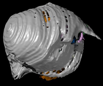 Ostracod (with Shell)