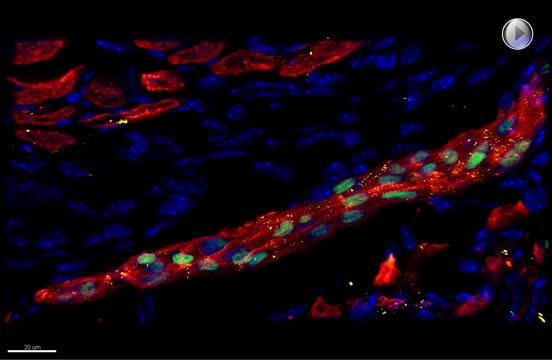 Human Heart Precursor Cells Self-Organised Into Human Muscle Fiber In Damaged Mouse Heart
