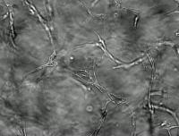 Capillary Growth